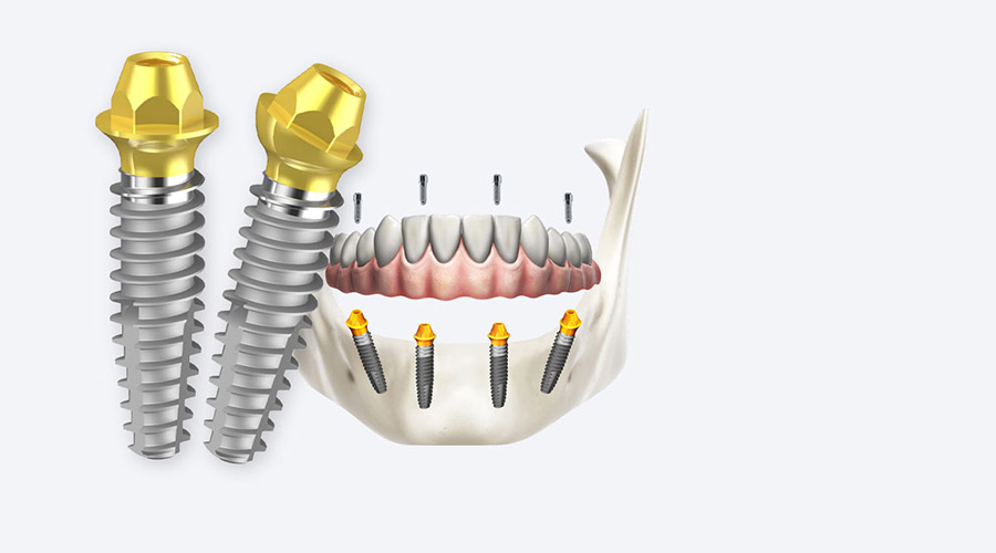 RESISTA - Unique System